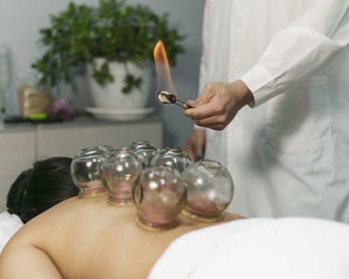 Cupping-Therapyy